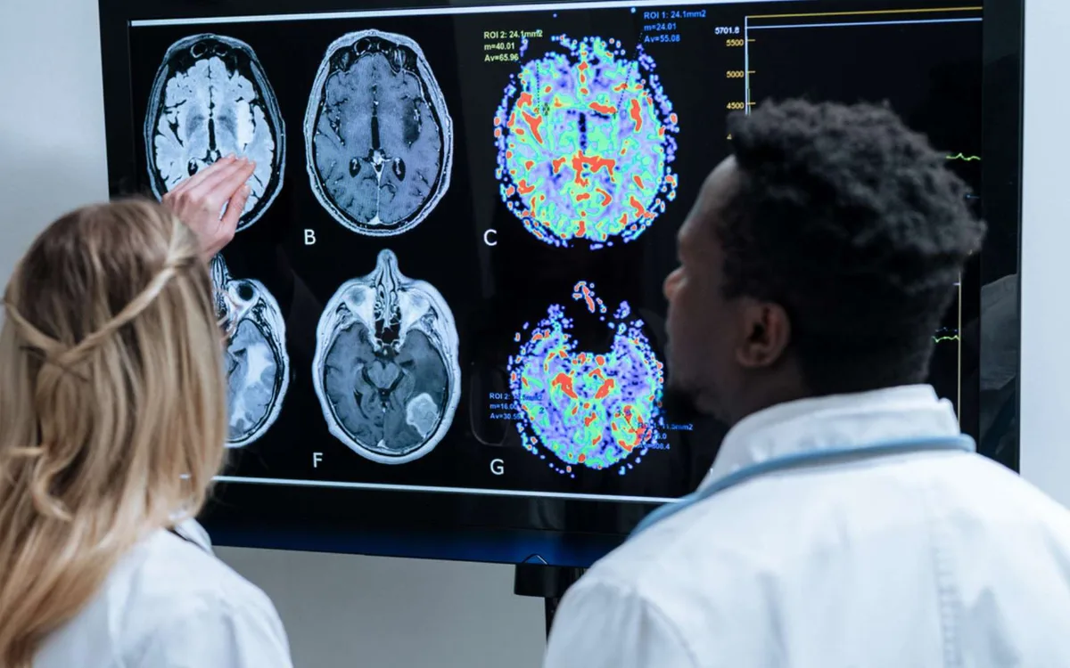 Alzheimer : un simple test de 10 minutes pourrait repérer la maladie jusqu'à 15 ans avant les premiers signes