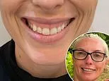 My gummy smile meant I always hid from photos or stopped myself laughing - until I found the five-minute solution. It's something I swore I'd NEVER do... but it finally has me grinning again