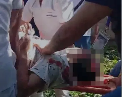 El Salvador: tres trabajadores resultaron lesionados tras caída de árbol durante acciones de limpieza, en la Asamblea Legislativa