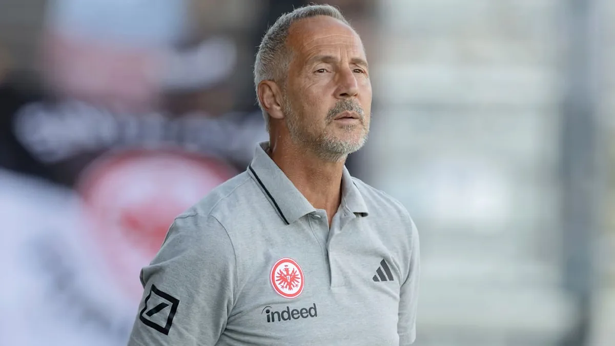 Trainer Hütter verkündet - Torwart-Entscheidung bei Eintracht gefallen