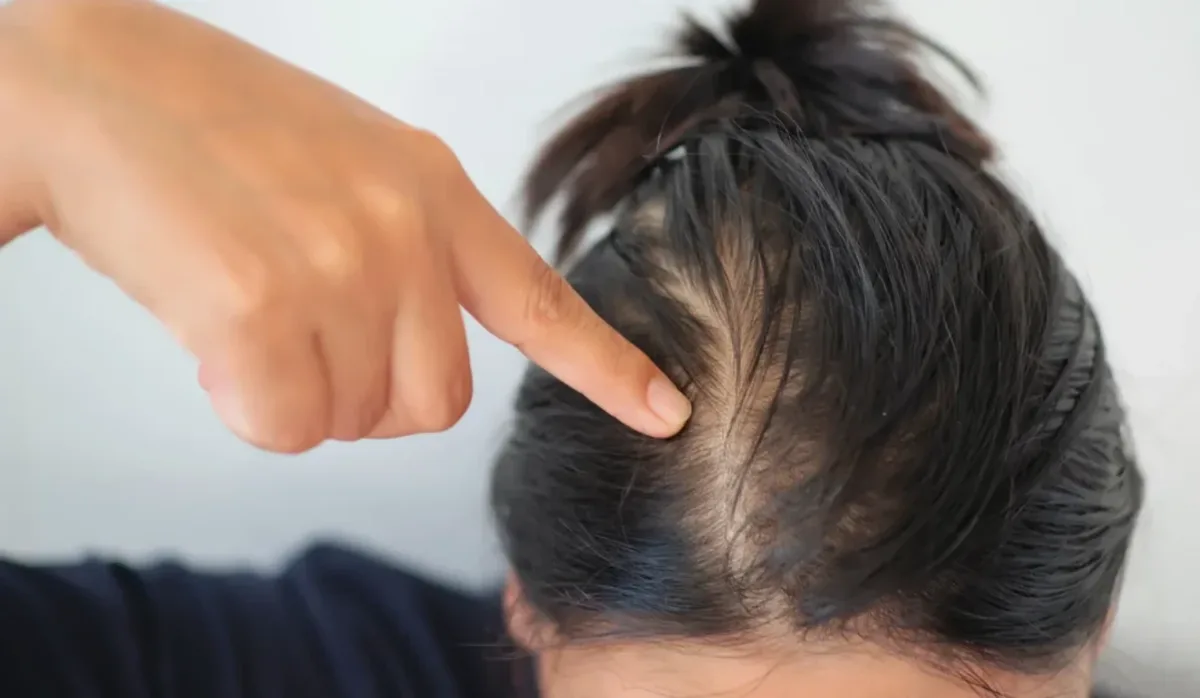Fios finos ou ralos? Veja 4 cuidados para encorpar o cabelo